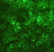 IF of A-431 cells labeled with DSHB antibody DSHB-GFP-8H11 against green fluorescent protein (GFP). Image credit: Soll Laboratory, University of Iowa. 